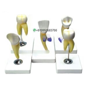 Human Teeth 6 Parts with Molar Anatomy Model for Biology Lab